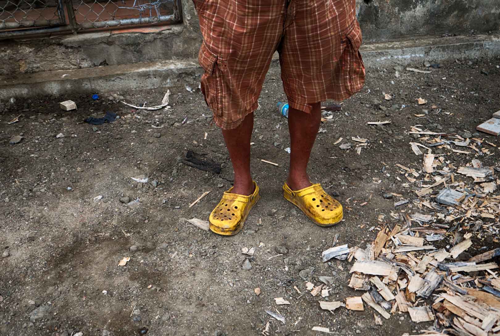 A Man In Brown Checkered Shorts With Bright Yellow Crocks