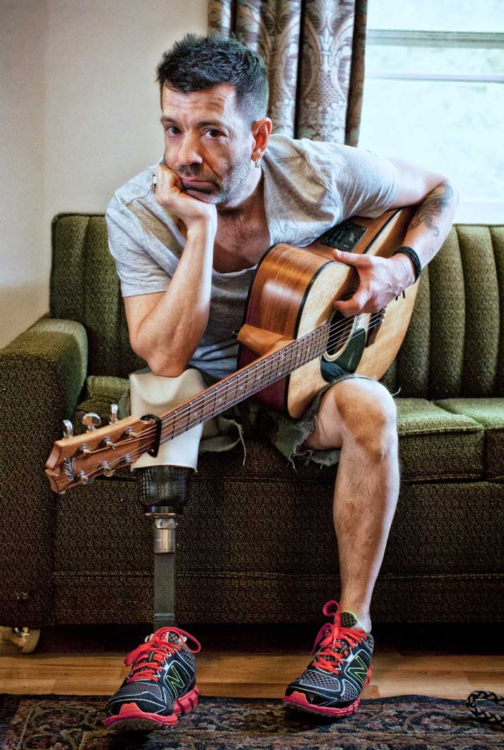 Singer-Songwriter And Cancer Amputee Travis Meadows