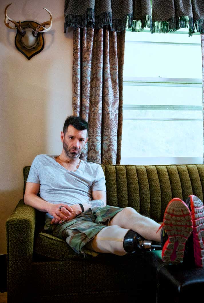 Cancer Survivor Recovery And Amputee Travis Meadows